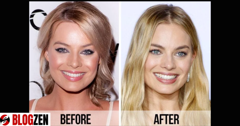 margot robbie plastic surgery​