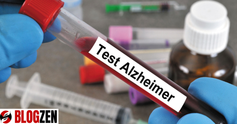 Alzheimer’s Blood Tests